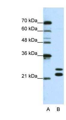 Western Blot: PIPPIN Antibody [NBP1-70673] - Titration: 0.625ug/ml, Positive Control: Jurkat cell lysate.