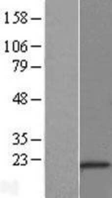 Western Blot: PIPPIN Overexpression Lysate (Adult Normal) [NBL1-09510] Left-Empty vector transfected control cell lysate (HEK293 cell lysate); Right -Over-expression Lysate for PIPPIN.