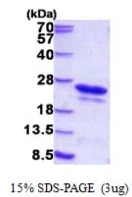 SDS-Page: PIPPIN Protein [NBP2-22792]