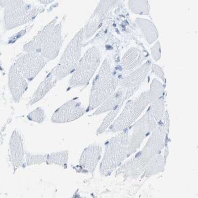 Immunohistochemistry-Paraffin: PITHD1 Antibody [NBP1-90717] - Staining of human skeletal muscle shows no positivity in myocytes as expected.