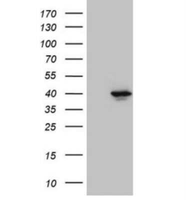 Western Blot: PITPNB Antibody (OTI6H10) - Azide and BSA Free [NBP2-73421] - HEK293T cells were transfected with the pCMV6-ENTRY control (Left lane) or pCMV6-ENTRY PITPNB (Right lane) cDNA for 48 hrs and lysed. Equivalent amounts of cell lysates (5 ug per lane) were separated by SDS-PAGE and immunoblotted with anti PITPNB.(1:2000)