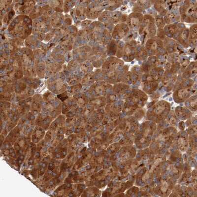 Immunohistochemistry-Paraffin PITPNM2 Antibody