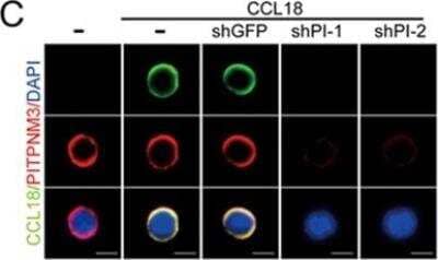 Immunocytochemistry/Immunofluorescence: PITPNM3 Antibody [NBP1-31070] - Representative fluorescence microscopy images of CCL18 binding to naive CD4+ T cells, knocked down or not for PITPNM3, stained for PITPNM3 and CCL18 3 h after adding CCL18. Scale bar, 5 um. Shown are the representative images for three independent experiments using PB T cells from three normal donors. Image collected and cropped by CiteAb from the following publication (nature.com/articles/cr201734), licensed under a CC-BY license.