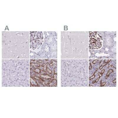 Immunohistochemistry-Paraffin PITPNM3 Antibody