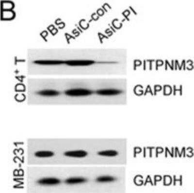 Knockdown Validated: PITPNM3 Antibody [NBP1-31070] - Representative immunoblots showing selective knockdown of PITPNM3 protein in PB CD4+ T cells, but not tumor xenografts (n = 3). Image collected and cropped by CiteAb from the following publication (nature.com/articles/cr201734), licensed under a CC-BY license.