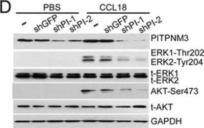 Knockdown Validated: PITPNM3 Antibody [NBP1-31070] - Immunoblot of CCL18-treated naive CD4+ T cells, knocked down or not for PITPNM3, showing expression of PITPNM3 and phosphorylated/total (t-) Erk1/2 and Akt, relative to GAPDH as a loading control. Blots are representative of data for three donors. Image collected and cropped by CiteAb from the following publication (nature.com/articles/cr201734), licensed under a CC-BY license.