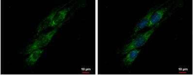 Immunocytochemistry/Immunofluorescence: PITRM1 Antibody [NBP2-19844] -  SKNSH cells were fixed in ice-cold MeOH for 5 min. Green: PITRM1 protein stained by PITRM1 antibody diluted at 1:500. Blue: Hoechst 33342 staining. Scale bar = 10 um.