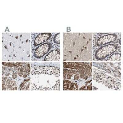 Immunohistochemistry-Paraffin: PITRM1 Antibody [NBP1-81728] - Staining of human cerebral cortex, colon, heart muscle and testis using Anti-PITRM1 antibody NBP1-81728 (A) shows similar protein distribution across tissues to independent antibody NBP1-81729 (B).