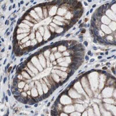 Immunohistochemistry-Paraffin: PITRM1 Antibody [NBP1-81728] - Staining of human colon.