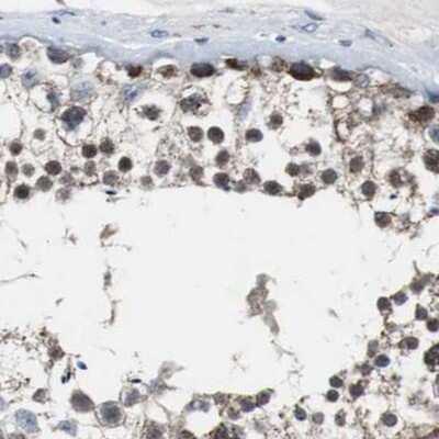 Immunohistochemistry-Paraffin: PITRM1 Antibody [NBP1-81728] - Staining of human testis.