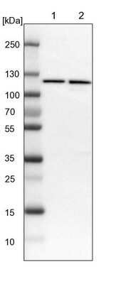 Western Blot: PITRM1 Antibody [NBP1-81728] - Lane 1: NIH-3T3 cell lysate (Mouse embryonic fibroblast cells). Lane 2: NBT-II cell lysate (Rat Wistar bladder tumor cells).