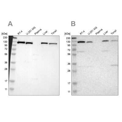 <b>Independent Antibodies Validation. </b>Western Blot: PITRM1 Antibody [NBP1-81728] - Analysis using Anti-PITRM1 antibody NBP1-81728 (A) shows similar pattern to independent antibody NBP1-81729 (B).