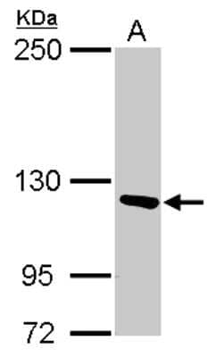 Western Blot: PITRM1 Antibody [NBP2-19843] - Sample (30 ug of whole cell lysate) A: A549 5% SDS PAGE gel, diluted at 1:1000.