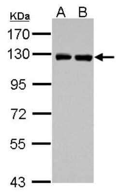 Western Blot: PITRM1 Antibody [NBP2-19844] - Sample (30 ug of whole cell lysate) A: PC-3 B: U87-MG 7. 5% SDS PAGE gel, diluted at 1:1000.