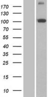 Western Blot: PITRM1 Overexpression Lysate (Adult Normal) [NBP2-07258] Left-Empty vector transfected control cell lysate (HEK293 cell lysate); Right -Over-expression Lysate for PITRM1.