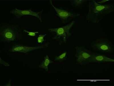 Immunocytochemistry/Immunofluorescence: PITX1 Antibody [H00005307-D01P] - Analysis of antibody to PITX1 on HeLa cell. Antibody concentration 10 ug/ml.