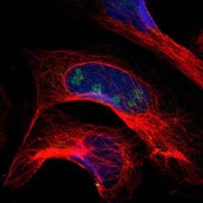 Immunocytochemistry/Immunofluorescence: PITX1 Antibody [NBP1-88644] - Staining of human cell line U-2 OS shows localization to nucleoli. Antibody staining is shown in green.