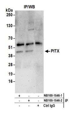 <b>Independent Antibodies Validation and Biological Strategies Validation.</b>PITX1 Antibody [NB100-1546] - Detection of human PITX by western blot of immunoprecipitates. Samples: Whole cell lysate (0.5 or 1.0 mg per IP reaction; 20% of IP loaded) from HeLa cells prepared using NETN lysis buffer. Antibodies: Affinity purified rabbit anti-PITX antibody NB100-1546 (lot NB100-1546-2) used for IP at 6 ug per reaction. PITX was also immunoprecipitated by a previous lot of this antibody NB100-1546-1. For blotting immunoprecipitated PITX, A300-577A was used at 1 ug/ml. Detection: Chemiluminescence with an exposure time of 3 minutes.