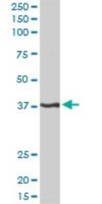 Western Blot: PITX1 Antibody [H00005307-D01P] - Analysis of PITX1 expression in human placenta.