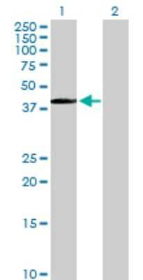 Western Blot: PITX1 Antibody [H00005307-D01P] - Analysis of PITX1 expression in transfected 293T cell line by PITX1 polyclonal antibody.Lane 1: PITX1 transfected lysate(34.10 KDa).Lane 2: Non-transfected lysate.