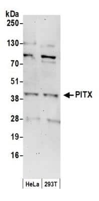 Western Blot: PITX1 Antibody [NB100-1546] - Detection of Human PITX by Western Blot. Samples: Whole cell lysate (50 ug) from HeLa and 293T cells prepared using NETN lysis buffer. Antibody: Affinity purified rabbit anti-PITX antibody NB100-1546 used for WB at 0.1 ug/ml. Detection: Chemiluminescence with an exposure time of 3 minutes.