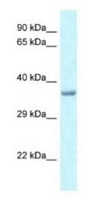 Western Blot: PITX1 Antibody [NBP1-82383] - Rat Liver Lysate 1.0 ug/ml, gel concentration 12%