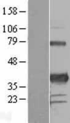 Western Blot: PITX3 Overexpression Lysate (Adult Normal) [NBL1-14449] Left-Empty vector transfected control cell lysate (HEK293 cell lysate); Right -Over-expression Lysate for PITX3.