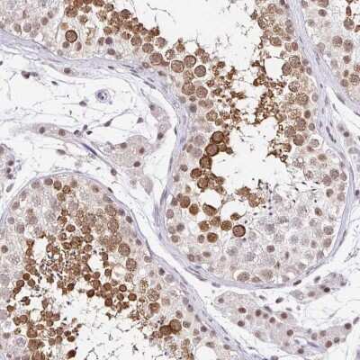 Immunohistochemistry-Paraffin: PIWIL1/HIWI Antibody [NBP2-33882] - Staining of human testis shows high expression.