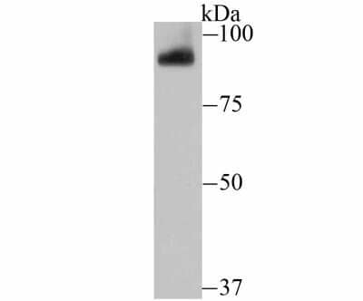 Western Blot: PIWIL1/HIWI Antibody (JU35-12) [NBP2-75619] - Analysis of PIWIL1 on mouse testis tissue lysate using anti-PIWIL1 antibody at 1/500 dilution.