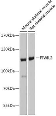 Western Blot: PIWIL2 Antibody [NBP2-93688] - Analysis of extracts of various cell lines, using PIWIL2 at 1:1000 dilution. Secondary antibody: HRP Goat Anti-Rabbit IgG (H+L) at 1:10000 dilution. Lysates/proteins: 25ug per lane. Blocking buffer: 3% nonfat dry milk in TBST. Detection: ECL Basic Kit . Exposure time: 5s.