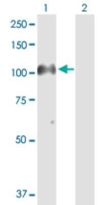 Western Blot: PIWIL4 Antibody [H00143689-D01P] - Analysis of PIWIL4 expression in transfected 293T cell line by PIWIL4 polyclonal antibody.Lane 1: PIWIL4 transfected lysate(93.50 KDa).Lane 2: Non-transfected lysate.