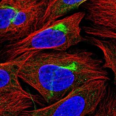 Immunocytochemistry/ Immunofluorescence PJA2/Praja2 Antibody