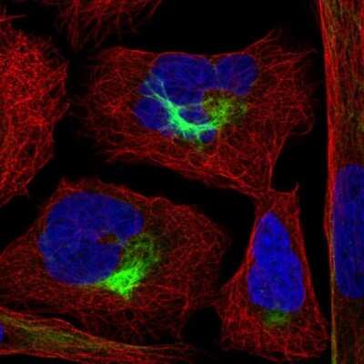 Immunocytochemistry/Immunofluorescence: PJA2/Praja2 Antibody [NBP2-56901] - Staining of human cell line U-2 OS shows localization to intermediate filaments.