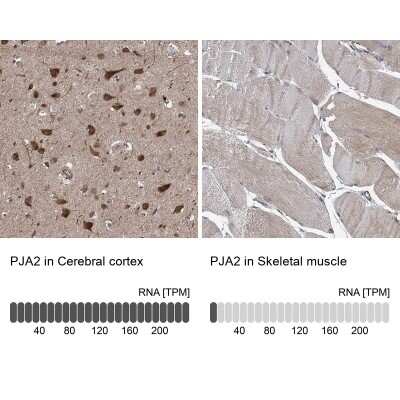 Immunohistochemistry-Paraffin: PJA2/Praja2 Antibody [NBP1-83006] - Staining in human cerebral cortex and skeletal muscle tissues using anti-PJA2 antibody. Corresponding PJA2 RNA-seq data are presented for the same tissues.