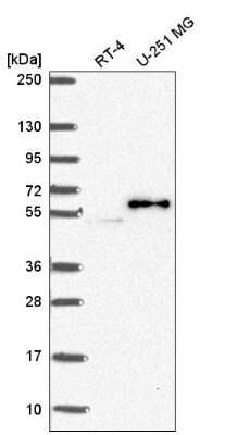 Western Blot: PJA2/Praja2 Antibody [NBP2-56901] - Analysis in human cell line RT-4 and human cell line U-251 MG.