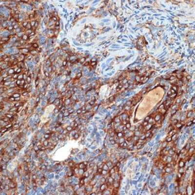 Immunohistochemistry-Paraffin: PKA 2 beta Antibody (2U2P1) [NBP3-15890] - Immunohistochemistry of paraffin-embedded rat ovary using PKA 2 beta Rabbit mAb (NBP3-15890) at dilution of 1:100 (40x lens).Perform microwave antigen retrieval with 10 mM Tris/EDTA buffer pH 9.0 before commencing with IHC staining protocol.