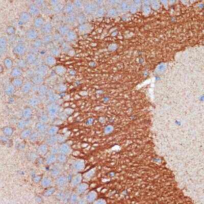 Immunohistochemistry-Paraffin: PKA 2 beta Antibody (2U2P1) [NBP3-15890] - Immunohistochemistry of paraffin-embedded mouse brain using PKA 2 beta Rabbit mAb (NBP3-15890) at dilution of 1:100 (40x lens).Perform microwave antigen retrieval with 10 mM Tris/EDTA buffer pH 9.0 before commencing with IHC staining protocol.