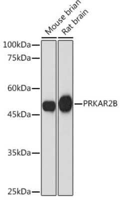 Western Blot: PKA 2 beta Antibody (2U2P1) [NBP3-15890] - Western blot analysis of extracts of various cell lines, using PKA 2 beta Rabbit mAb (NBP3-15890) at 1:1000 dilution. Secondary antibody: HRP Goat Anti-Rabbit IgG (H+L) at 1:10000 dilution. Lysates/proteins: 25ug per lane. Blocking buffer: 3% nonfat dry milk in TBST. Detection: ECL Basic Kit. Exposure time: 180s.