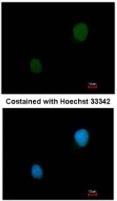 Immunocytochemistry/Immunofluorescence: PKA 2 beta Antibody [NBP1-33773] - Analysis of methanol-fixed HeLa, using antibody at 1:200 dilution.