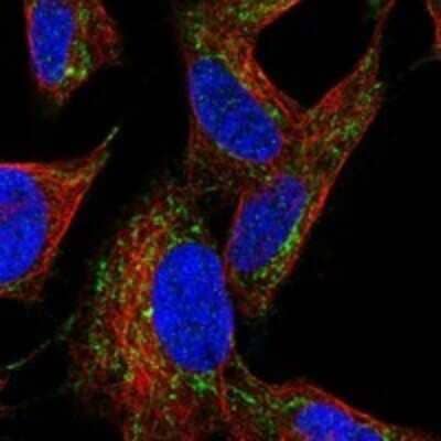 Immunocytochemistry/Immunofluorescence: PKA 2 beta Antibody [NBP3-17753] - Staining of human cell line SH-SY5Y shows localization to mitochondria.