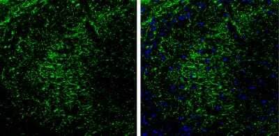 Immunohistochemistry-Frozen: PKA 2 beta Antibody [NBP1-33773] -  Frozen Sectioned adult mouse hippocampus. Green: PKA 2 beta protein stained by PKA 2 beta antibody diluted at 1:250. Blue: Fluoroshield with DAPI. Antigen Retrieval: Citrate buffer, pH 6.0, 10 min