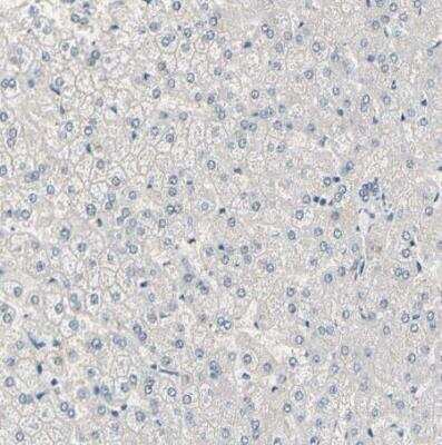 Immunohistochemistry-Paraffin: PKA 2 beta Antibody [NBP1-80879] - Staining of human liver shows no positivity in hepatocytes as expected.