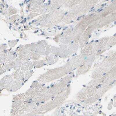 Immunohistochemistry-Paraffin: PKA 2 beta Antibody [NBP1-80879] - Staining of human skeletal muscle shows no positivity in myocytes as expected.