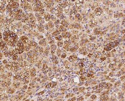 Immunohistochemistry-Paraffin: PKA 2 beta Antibody [NBP3-12636] - Staining of human PRKAR2B in human adrenal gland with rabbit polyclonal antibody at 1:1000.