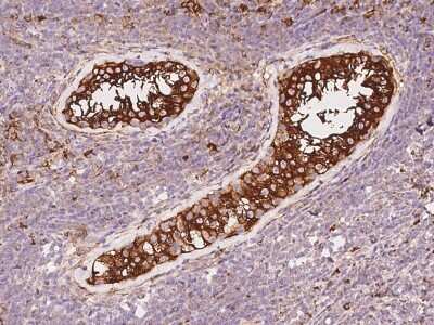 Immunohistochemistry-Paraffin: PKA 2 beta Antibody [NBP3-12636] - Immunochemical staining of human PKA 2 beta in human testis with rabbit polyclonal antibody at 1:1000 dilution, formalin-fixed paraffin embedded sections.