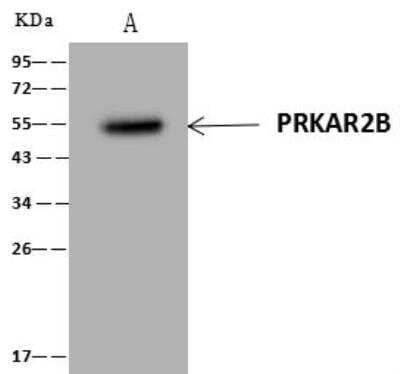 Immunoprecipitation: PKA 2 beta Antibody [NBP3-12636] - Lane A:0.5 mg NIH/3T3 Whole Cell Lysate4 uL anti-PRKAR2B rabbit polyclonal antibody and 60 ug of Immunomagnetic beads Protein A/G.Primary antibody:Anti-PRKAR2B rabbit polyclonal antibody,at 1:100 dilution Secondary antibody:Clean-Blot IP Detection Reagent (HRP) at 1:1000dilutionDeveloped using the ECL technique.Performed under reducing conditions.Predicted band size: 46 kDaObserved band size :54 kDa