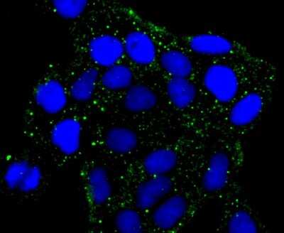 Immunocytochemistry/Immunofluorescence: PKA 2 beta Antibody (JA11-69) [NBP2-67061] - Staining PKA 2 beta (regulatory subunit) in Hela cells (green). The nuclear counter stain is DAPI (blue). Cells were fixed in paraformaldehyde, permeabilised with 0.25% Triton X100/PBS.