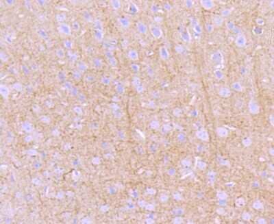 Immunohistochemistry-Paraffin: PKA 2 beta Antibody (JA11-69) [NBP2-67061] - Analysis of paraffin-embedded mouse brain tissue using anti- PKA 2 beta (regulatory subunit) antibody. Counter stained with hematoxylin.