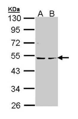 Western Blot: PKA 2 beta Antibody [NBP1-33773] - Sample (30 ug of whole cell lysate) A: Hela B: Hep G2 10% SDS PAGE; antibody diluted at 1:1000.