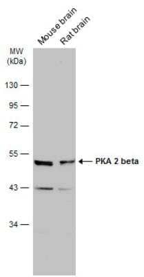 Western Blot: PKA 2 beta Antibody [NBP1-33773] - Various tissue extracts (50 ug) were separated by 10% SDS-PAGE, and the membrane was blotted with PKA 2 beta antibody diluted at 1:1000. The HRP-conjugated anti-rabbit IgG antibody (NBP2-19301) was used to detect the primary antibody.